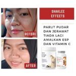 Testimoni ESP Shaklee untuk kulit cantik